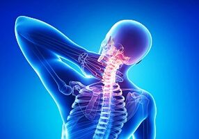complicații probabile cu o joncțiune de osteochondroză