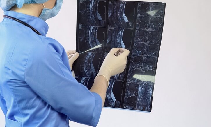 Diagnosticul de „osteocondroză cervicală se face pe baza unui studiu RMN